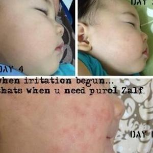 PUROL ZALF ONGUENT 50ML ORIGINAL SALEP UNTUK PERAWATAN LUKA GATAL KULIT RUAM AMAN UNTUK BAYI DAN ANA