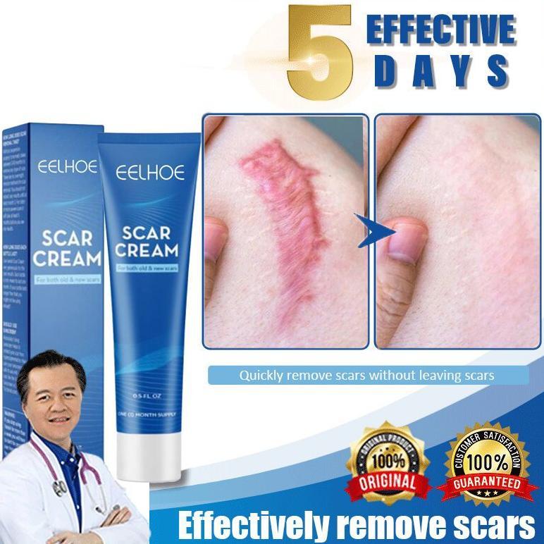 penghilang bekas luka lama paling 20g bekas luka Memperbaiki bekas luka lama dan baru Termurah