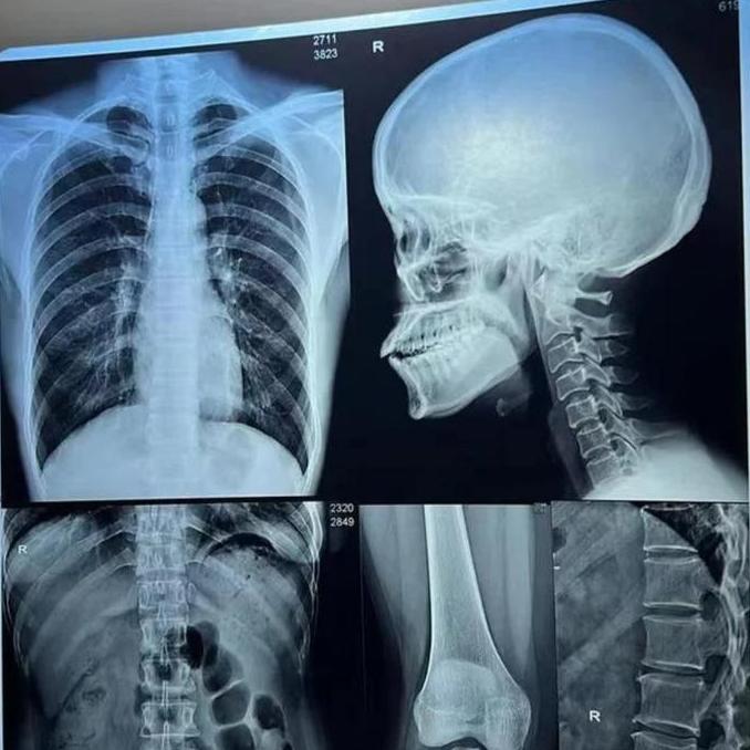 DIGITAL FILM INKJET MEDICAL DRY FILM A4