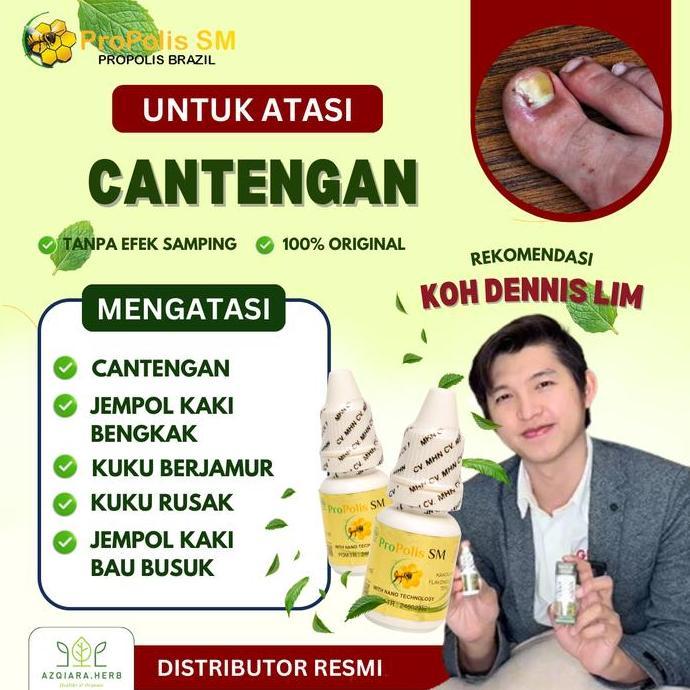 NEW PROPOLIS SM TETES KAKI CANTENGAN, CANTENGAN BERNANAH, CANTENGAN DI JEMPOL KAKI, TETES JEMPOL KAK