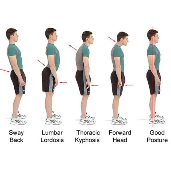 POSTURE CORRECTOR PENEGAK PUNGGUNG POSTUR PENYANGGA PUNGGUNG WANITA