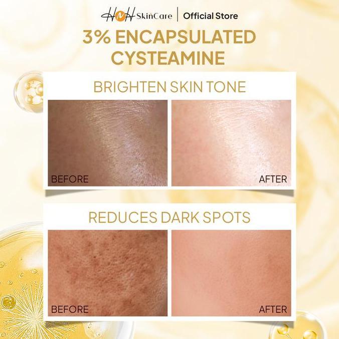 Tenzione- Snature By Kamila - Cysteamine Glow Booster Whitening Cream - Cysteamine Cream Untuk Flek 