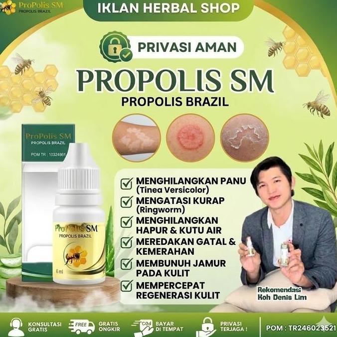 Youyou- Propolis Sm P Untuk Panu Hapur Kurap / Penghilang Panu Gatal Di Jah Tangan Kaki Hitam