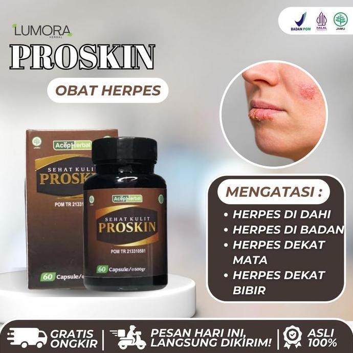 Proskin Isi 50 Kapsul  Herbal Alami Obat untuk Herpes Dekat Mata,Herpes Di Dahi Herpes Dekat Bibir