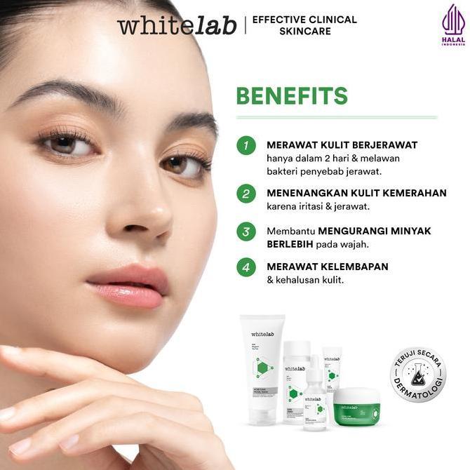 Skin- Whitelab 5Pcs Paket Acne Lengkap - Facial Sh, Toner, Serum, Moisturizer, Acne Cream Paket Skin