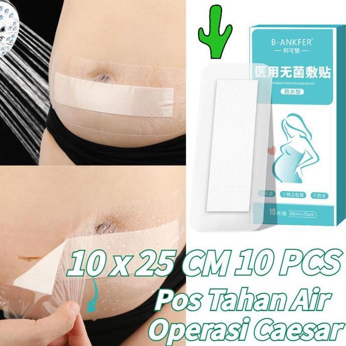RGPOTZ 10PCS 10 x 25 CM Operasi Caesar Plester Luka Cesar Plaster Pasca Operasi Sesar Plester Putih 