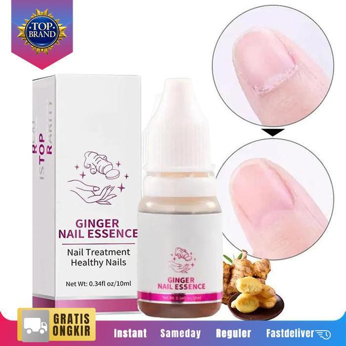 10Ml Jamur Kuku Tangan Kuku Berjamur Dan Rusak Perawatan Kuku Tangan Dan Kaki Obat Kuku Ampuh