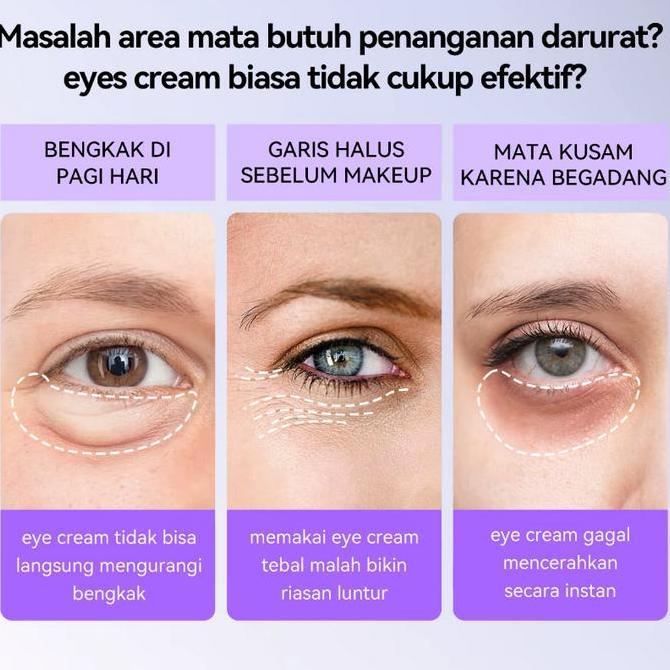 BPOMKrim Mata Retinol 5X mengatasi kerutan, lingkaran hitam, kendur, kantong mata bengkak, dan mata 