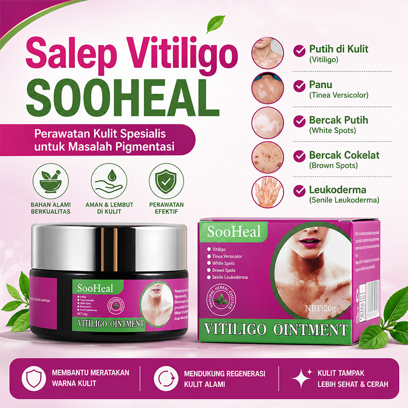 Salep vitiligo ori 100%,Vitiligo salep kulit,20g,Salep Vitiligo SOOHEAL,Menyamarkan bercak putih,Men
