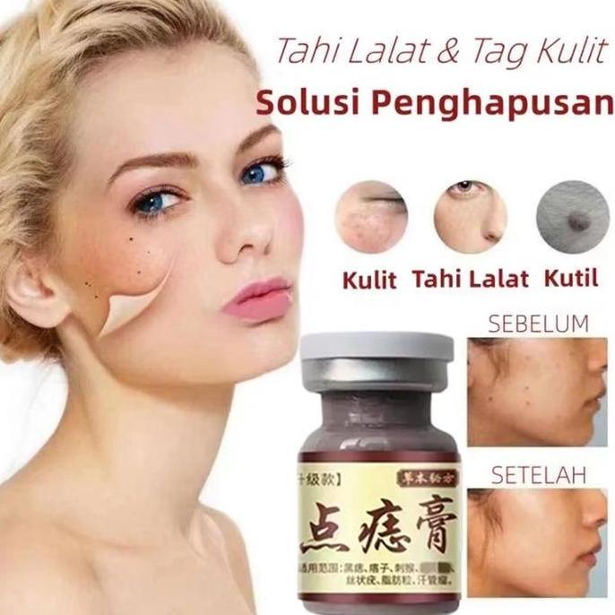 Faceid- New- Efek Bagus Obat Kutil Paling Ampuh Oles Penghilang Kutil Manjur Tanpa Operasi Mahal Pen