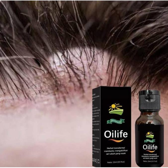 TERLARIS OILIFE - MINYAK OLES BENJOLAN DI KEPALA ORINAL BPOM