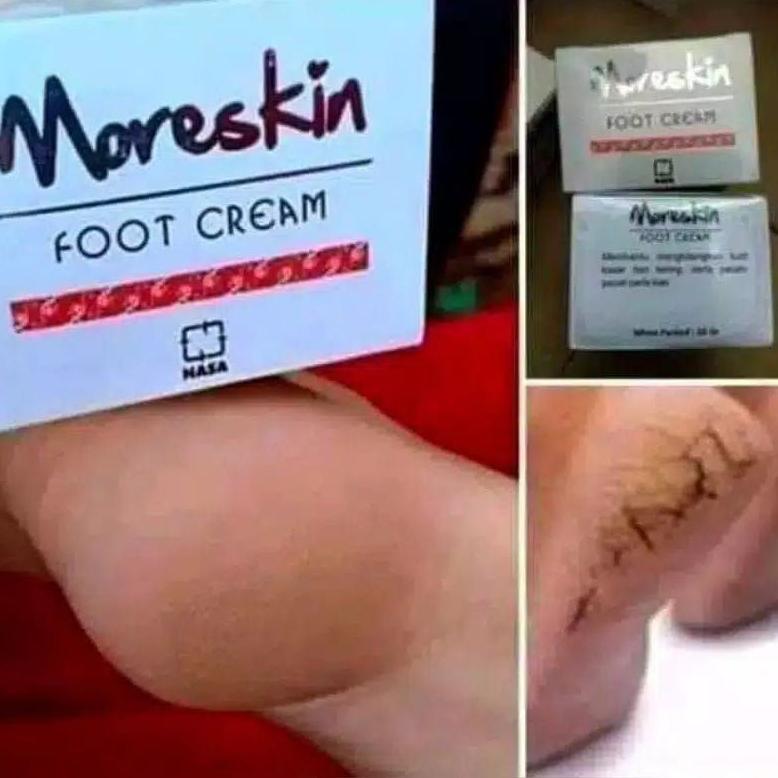 NEW Kaki pecah dan kering - Kaki pecah - Kaki pecah dan kering ampuh - Kaki pecah2 - Kaki pecah dan 