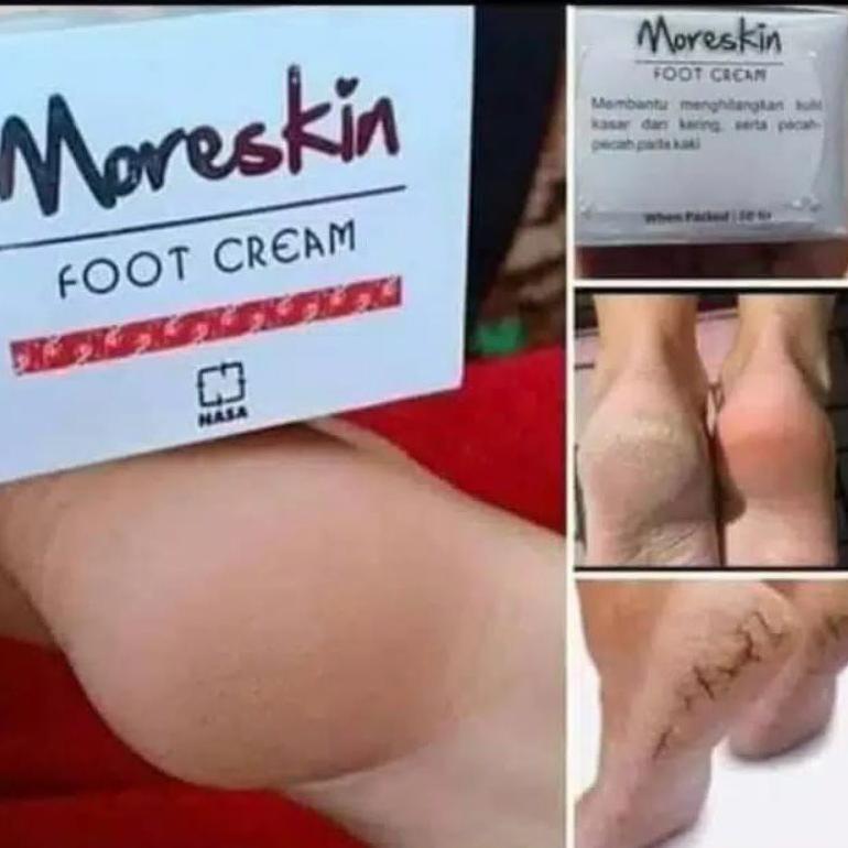 NEW Obat kaki pecah2 - Obat kaki pecah dan kering  - Food Cream Nasa - Cream kaki pecah2 - Cream kak