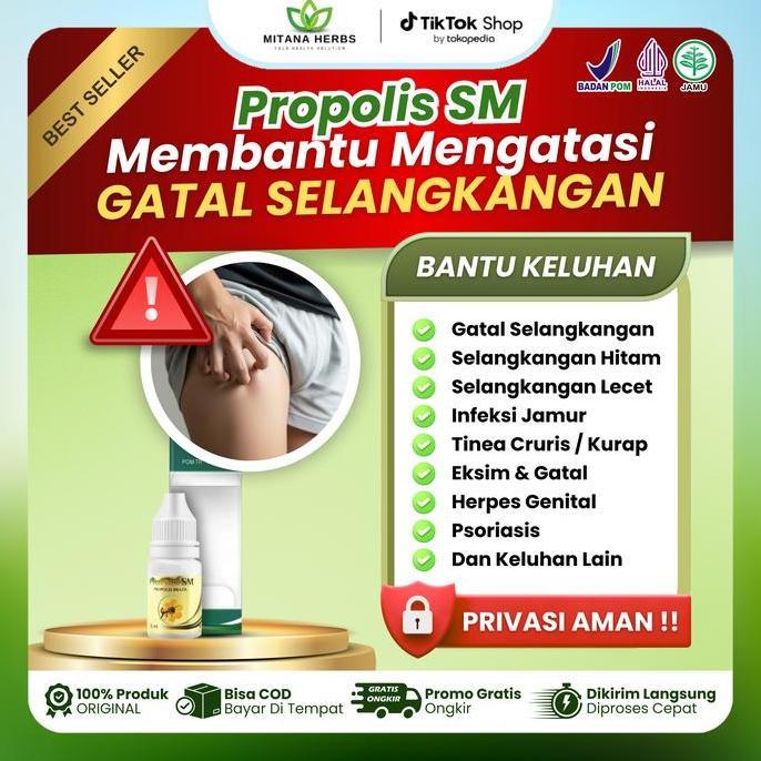 Zerox- Propolis Sm Gatal Selangkangan Hitam Di Selangkangan Ruam Merah Lecet Kulit Gatal Kelamin Pri