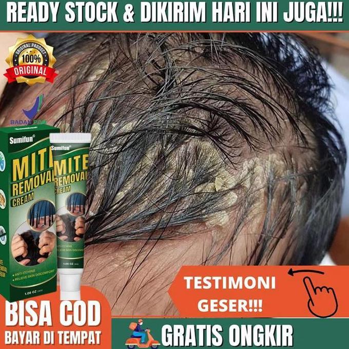 Obat Borok Di Kepala Obat Ketombe Berkerak Di Kulit Kepala Jamur Kulit Kepala Obat Ketombe Psoriasis
