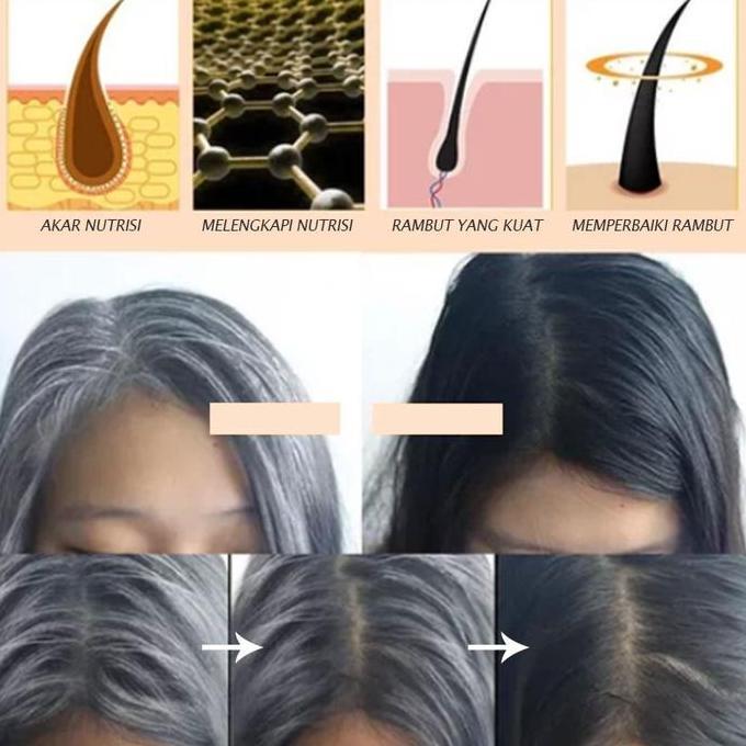 Penghitam Rambut Uban Permanen Rambut Uban Menjadi Hitam Permanen Serum Rambut Hitam Penghitam Rambu