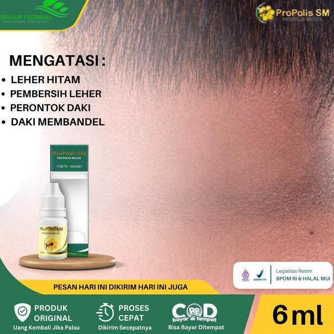 ProPolis SM Untuk Pemutih Leher Hitam, Memutihkan Tengkuk Leher Yang Hitam, Pemutih Daki Hitam Di Le