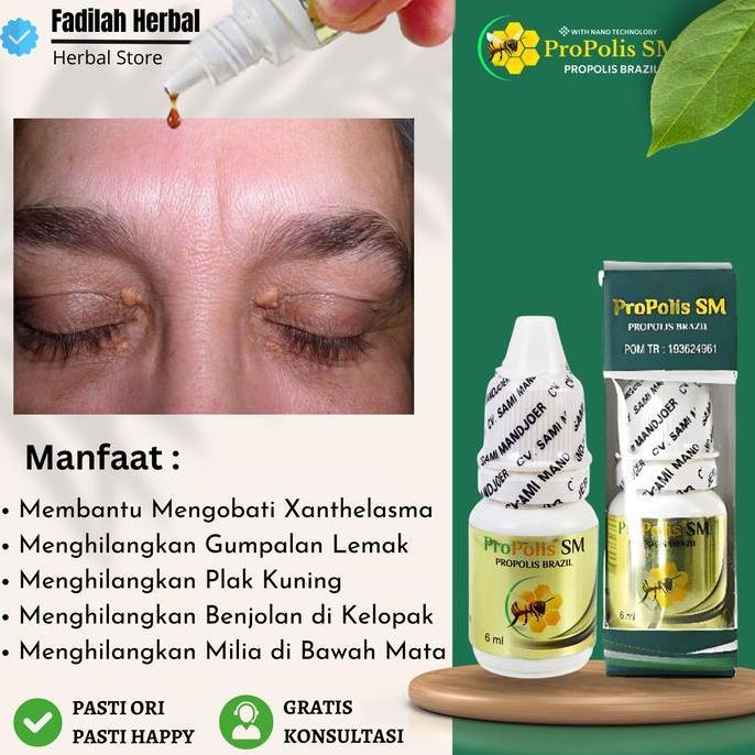 Obat Pembersih Xanthelasma Herbal Propolis SM Brazil
