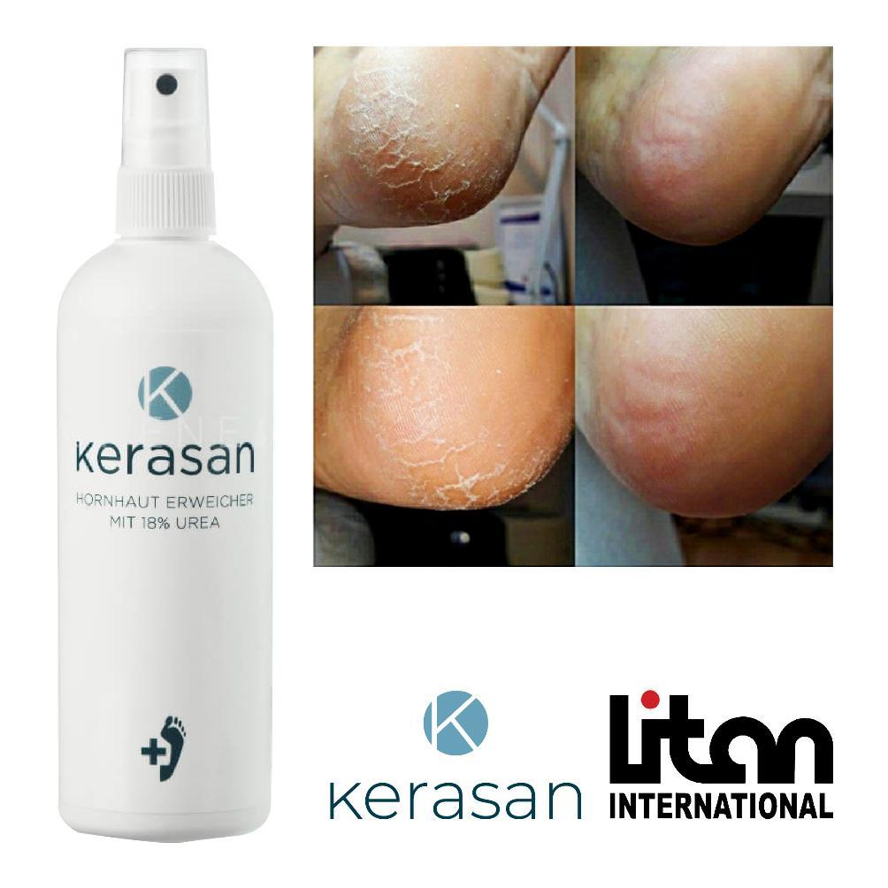 NEW Callus Softener Spray Callusan Non Gehwol Non Footlogix Kapalan Kaki Pecah Pedicure Termurah Ber