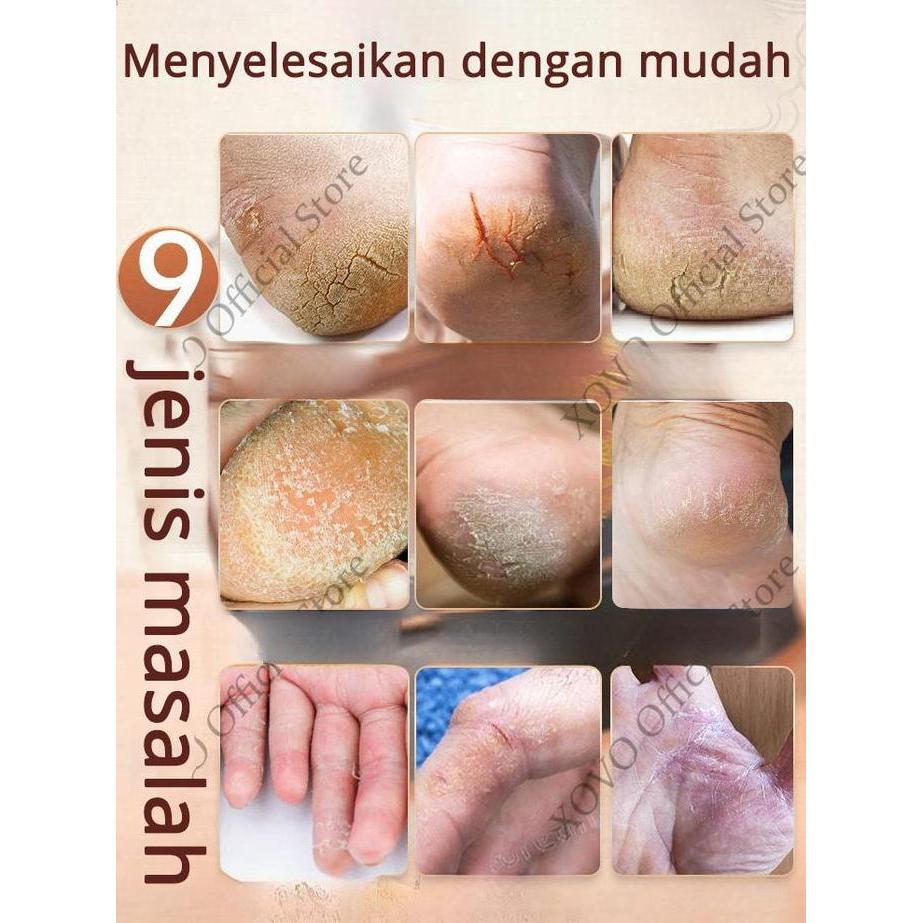pelembab kaki pecah dan kering kaki obat kaki pecah dan kering krim 60g salep kaki pecah pecah kerin