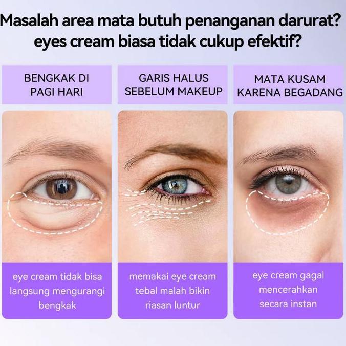 Zena_groupabadi - BPOMKrim Mata Retinol 5X mengatasi kerutan, lingkaran hitam, kendur, kantong mata 