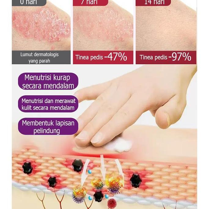 Haut- BpomSalep Eksim Kering Paling Ampuh 30G- Cream Mengobati Eksim Calming Cream Untuk Pereda Eksi