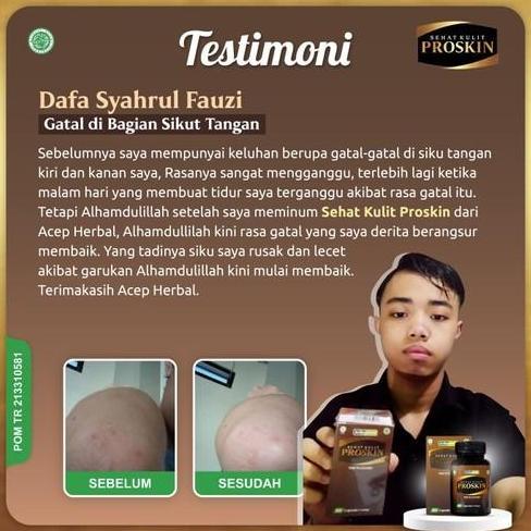 Warehouse- Sehat Kulit Proskin Herbal 60 Kapsul