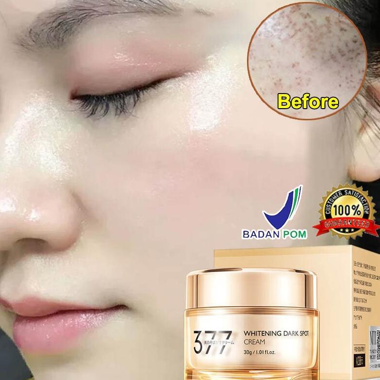 377 cream flek hitam membandel Cream penghilang flek hitam Dark spot serum Menghilangkan flek hitam 