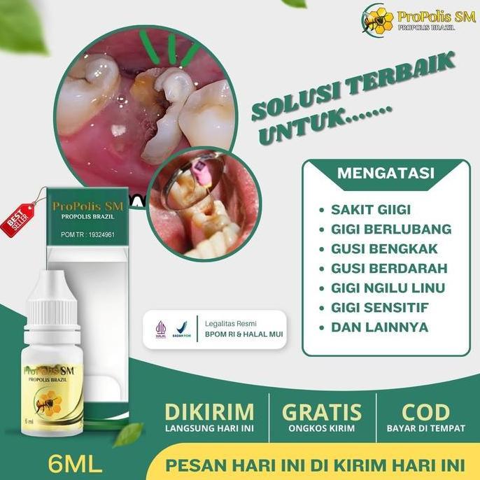 Propolis SM - Obat Tetes Sakit Gigi, Meredakan Sakit Gigi, Gigi Berlubang, dan Gusi Bengkak