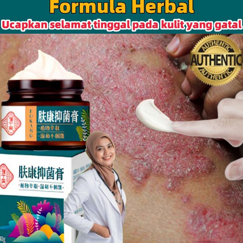 100% gatal paling Obat obat gatal kutil Obat Gatal gatal 30G gatal selangan obat gatal kulit Kulit K