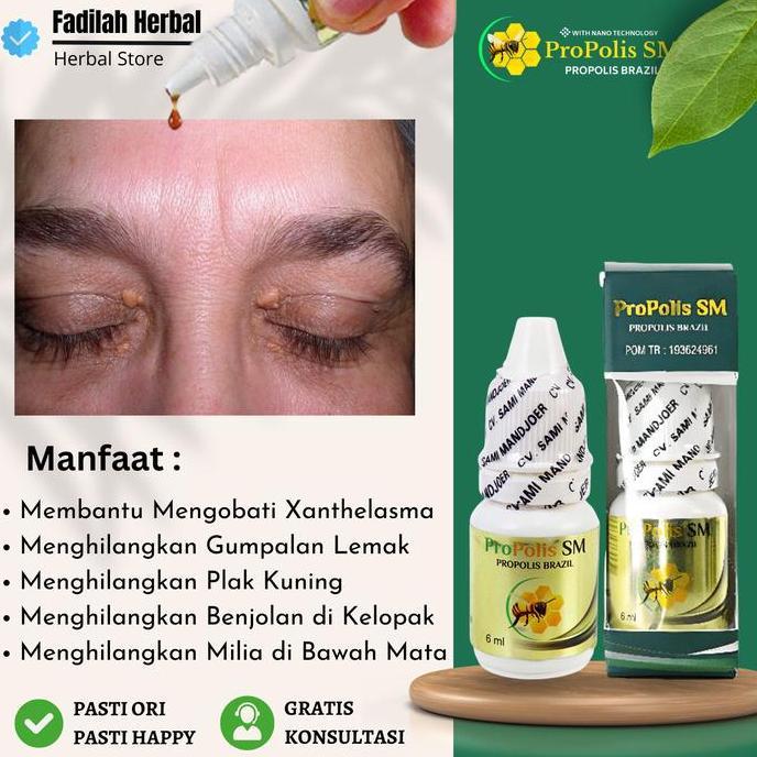 Obat Pembersih Xanthelasma Herbal Propolis SM Brazil