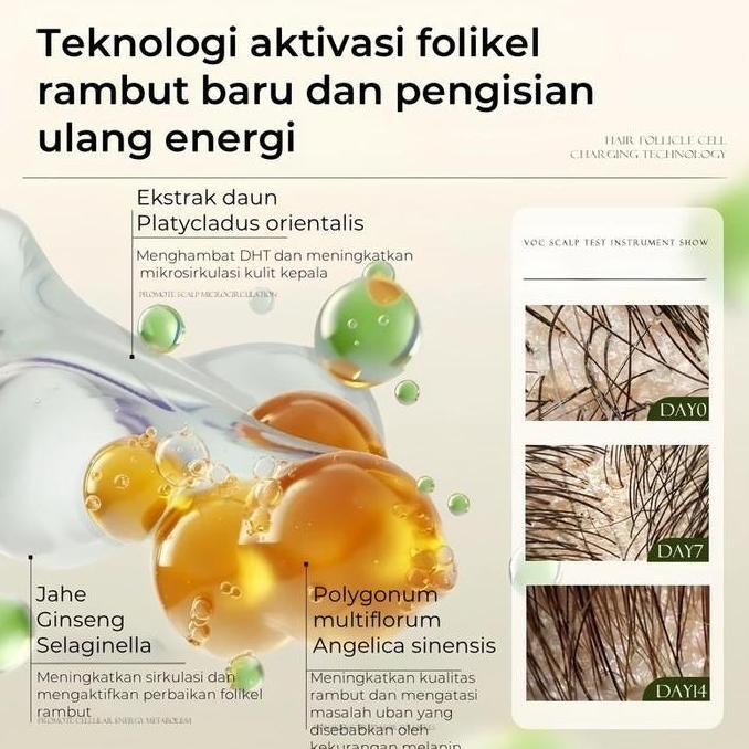 REMIMPI Hair Loss Treatment Shampoo 300ml3PCSHadiah terbatas REMIMPI Hair Tonic 50ml