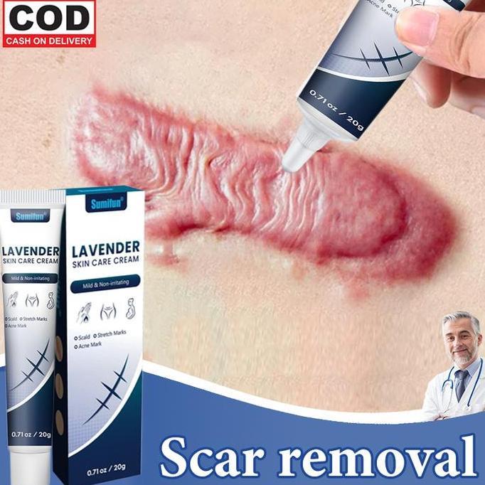 Penghilang bekas luka Scar Remover Cream 20g penghilang bekas luka keloid salep Lama Hitam Koreng Sa