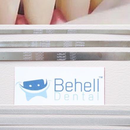 Kikir Gigi Dental Abrasive Strip Steelcarbo Strip Horico . Polishing Finishing Penghilang Lem Behel 