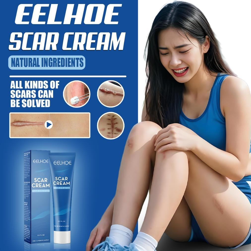 EELHOE bekas luka dermatik penghilang bekas luka ori/obat penghilang bekas luka koreng hitam lama/Pe