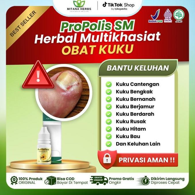 ProPolis SM Oles Kuku Cantengan Kaki Bengkak Berjamur Bengkak Bernanah Kuku Bau Cantengan Tangan Kak