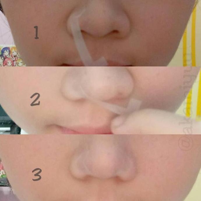 TA waterproof face lift tape v shape selotip lakban pembentuk muka wajah