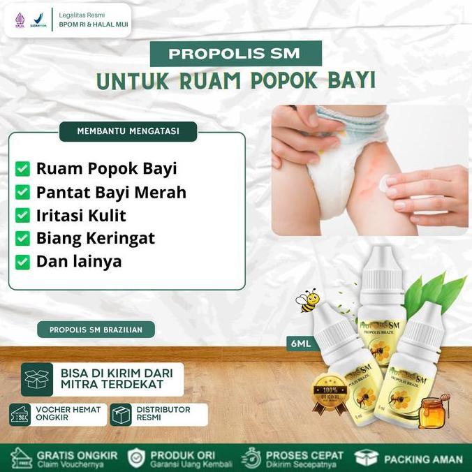 Propolis SM Solusi Untuk Mengatasi Ruam Popok Bayi, Ruam Pantat Bayi Merah Gatal Gatal, Iritasi Kuli