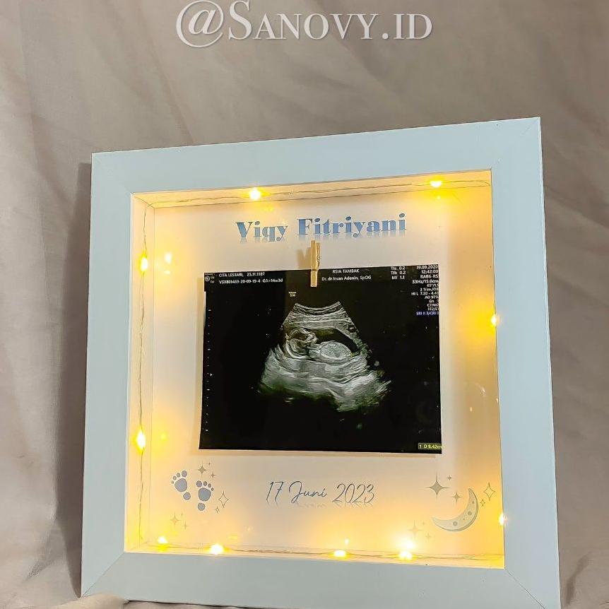 2020012 Pigura / Frame 3D Usg Baby Photo Frame
