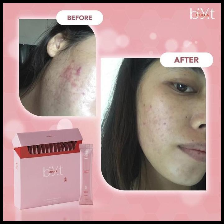 Byt Colla 2 Box - Kolagen / Collagen Tripeptide Terlaris
