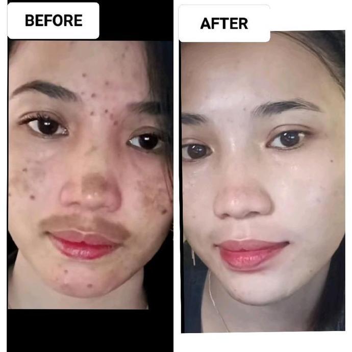 Clips- Js Skincare Ready Brtening Nht Cream Js Skincare Exclusive Krim Glowing/ Krim Flek Hitam/Krim