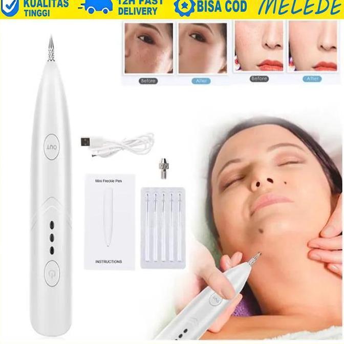 MELEDE Flek Kutil Tahi Lalat Tato Black Spot Removal Pen/ Alat Laser Plasma Pen Penghilang Kutil Tah
