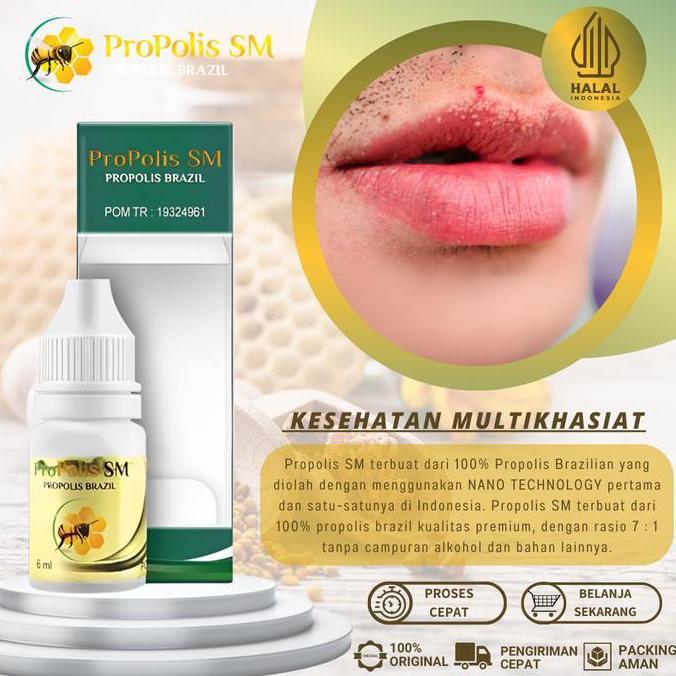SALE - Propolis SM - Penghilang Bintik Putih Di Bibir, Fordyce Spots, Bintik Putih di Bibir Fordyce 