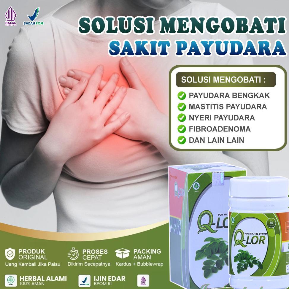 (Terbaru) Obat Payudara Bengkak Dan Nyeri Paling Ampuh Mastitis Abses Payudara Benjolan Susu Tumor J