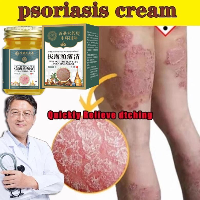 Terlaris Krim Psoriasis Krim Antijamur Krim Eksim Salep Kulit Serbaguna Gatal, Jamur & Psoriasis Hil