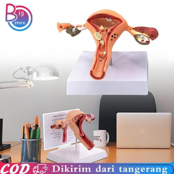 DISSORDE Uterus Ovary Anatomical Model Anatomy Alat Peraga Anatomi Model Patologis Uterus Ovarium Ma