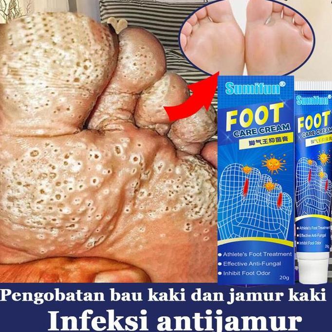 Salep Kaki Ampuh obat kaki Rayapan Dan Bau penghilang bau kaki obat jamur kaki pembersih kulit mati 