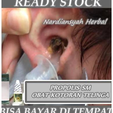 Obat Tetes Penghancur Kotoran Telinga Keras / Lunak, Obat Telinga