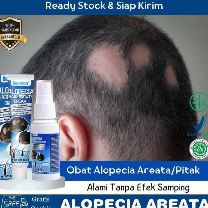 Lansungkirim- Obat Pitak Obat Alopecia Areata, Obat Penumbuh Rambut Botak, Obat Botak Koin, Obat Ram