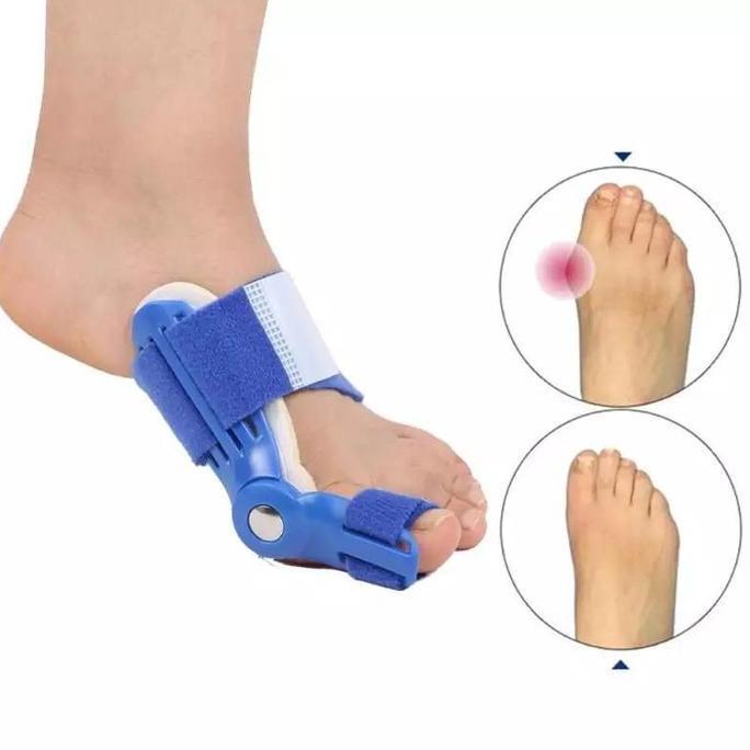 ceviscell77 - insole kaki bunion dan hallux valgus corrector kaki bunion insole jari kaki bengkok te